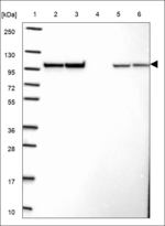 SPG7 Antibody in Western Blot (WB)