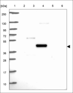 SLC46A1 Polyclonal Antibody