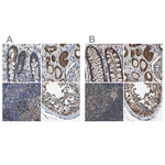 FHIT Polyclonal Antibody