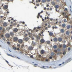 FHIT Antibody in Immunohistochemistry (Paraffin) (IHC (P))