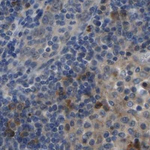 FHIT Antibody in Immunohistochemistry (Paraffin) (IHC (P))