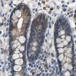 FHIT Antibody in Immunohistochemistry (Paraffin) (IHC (P))