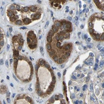 FHIT Antibody in Immunohistochemistry (Paraffin) (IHC (P))