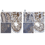 FHIT Polyclonal Antibody