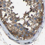 FHIT Antibody in Immunohistochemistry (Paraffin) (IHC (P))