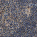 FHIT Antibody in Immunohistochemistry (Paraffin) (IHC (P))