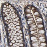 FHIT Antibody in Immunohistochemistry (Paraffin) (IHC (P))