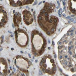FHIT Antibody in Immunohistochemistry (Paraffin) (IHC (P))