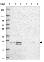 ZCRB1 Antibody in Western Blot (WB)