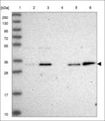 PITPN Polyclonal Antibody