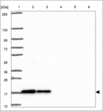 SRP14 Antibody in Western Blot (WB)