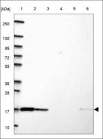 SRP14 Polyclonal Antibody