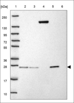 CFHR3 Antibody in Western Blot (WB)