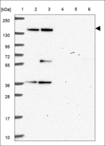 ASXL1 Antibody in Western Blot (WB)