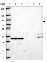 KLHL22 Polyclonal Antibody