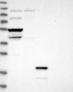 STARD3 Polyclonal Antibody