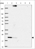 RAP2B Polyclonal Antibody