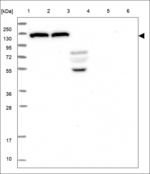 Adenylate Cyclase 6 Antibody in Western Blot (WB)