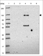 CORIN Antibody in Western Blot (WB)