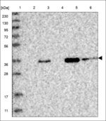 PBX3 Antibody in Western Blot (WB)