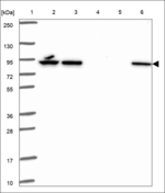 GCN5 Antibody in Western Blot (WB)