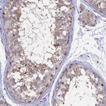 LXR alpha Polyclonal Antibody
