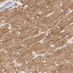 ADAMTS9 Antibody in Immunohistochemistry (Paraffin) (IHC (P))