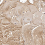 ADAMTS9 Antibody in Immunohistochemistry (Paraffin) (IHC (P))