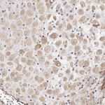 ADAMTS9 Antibody in Immunohistochemistry (Paraffin) (IHC (P))