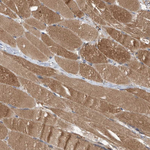 SLC25A10 Antibody in Immunohistochemistry (Paraffin) (IHC (P))
