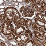 SLC25A10 Polyclonal Antibody