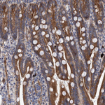 SLC25A10 Antibody in Immunohistochemistry (Paraffin) (IHC (P))