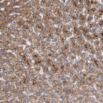 SLC25A10 Antibody in Immunohistochemistry (Paraffin) (IHC (P))