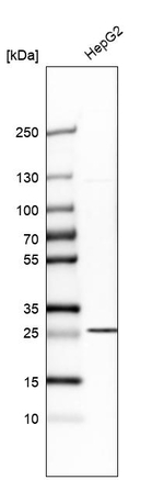 SLC25A10 Antibody in Western Blot (WB)