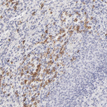 LTB4R Polyclonal Antibody