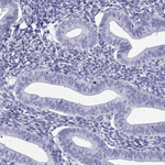 PDE6A Antibody in Immunohistochemistry (Paraffin) (IHC (P))