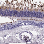 PDE6A Antibody in Immunohistochemistry (Paraffin) (IHC (P))
