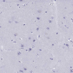 PDE6A Antibody in Immunohistochemistry (Paraffin) (IHC (P))