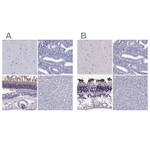 PDE6A Polyclonal Antibody