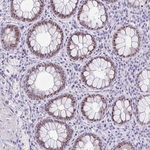 NR1D2 Antibody in Immunohistochemistry (Paraffin) (IHC (P))