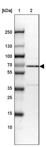 NR1D2 Antibody in Western Blot (WB)