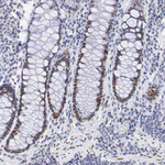 FOXP2 Antibody in Immunohistochemistry (Paraffin) (IHC (P))