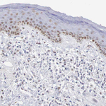 FOXP2 Antibody in Immunohistochemistry (Paraffin) (IHC (P))
