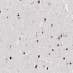 FOXP2 Polyclonal Antibody