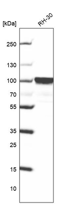 FOXP2 Antibody in Western Blot (WB)