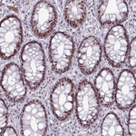 NCoR1 Antibody in Immunohistochemistry (Paraffin) (IHC (P))