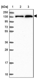 NCoR1 Antibody in Western Blot (WB)