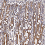 PRMT2 Antibody in Immunohistochemistry (Paraffin) (IHC (P))