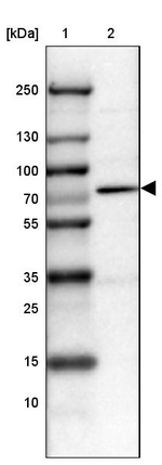 PRMT2 Antibody in Western Blot (WB)