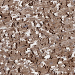 VEGFD Antibody in Immunohistochemistry (Paraffin) (IHC (P))